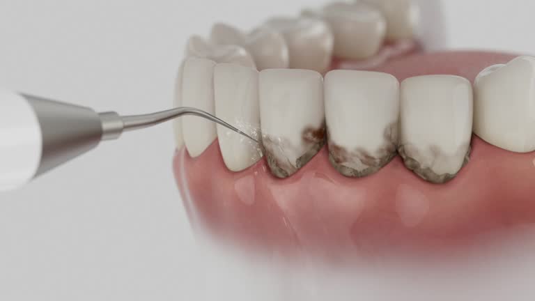 Reliable Root Canal Treatment contractor in Carroll County County, AR by Dentist Open Now